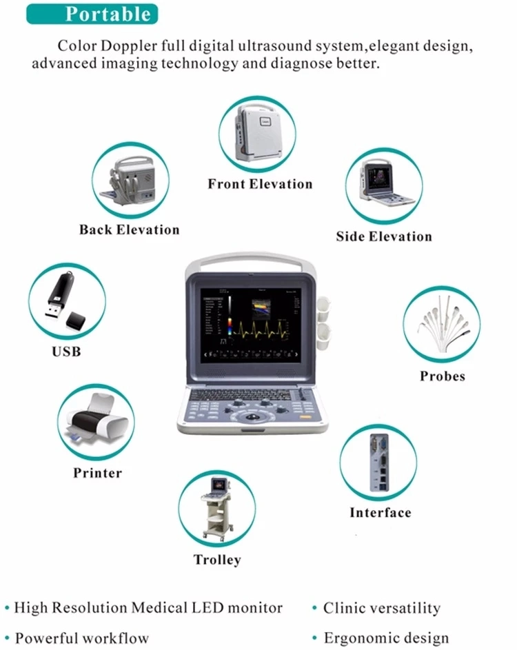 Medical Diagnosis Equipment Cardiac Color Doppler Portable 4D Ultrasound Scanner