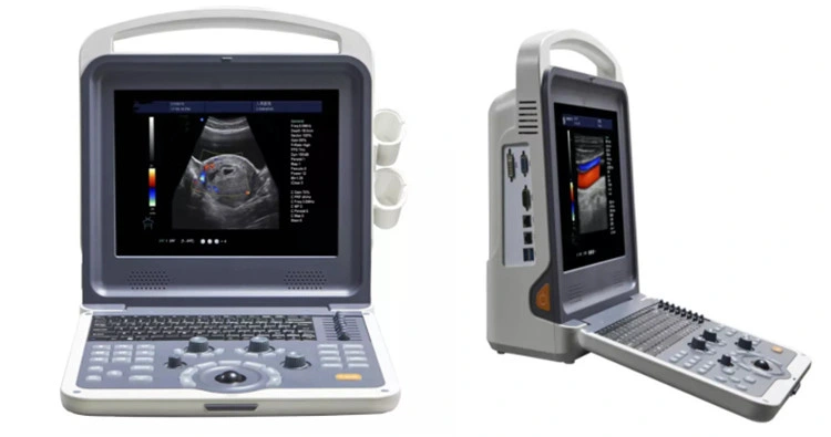 Ce Approved Medical Portable 4D Color Doppler Ultrasound Scanner