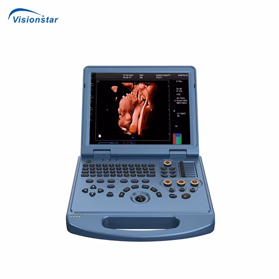 Scanner de ultrassom Doppler colorido para equipamentos de diagnóstico médico
