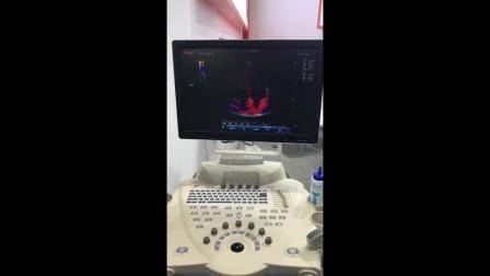 Scanner de ultrassom Doppler colorido 4D barato para diagnóstico clínico